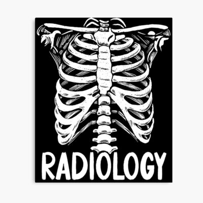 Radiology Ribcage X Ray Technologist Poster
